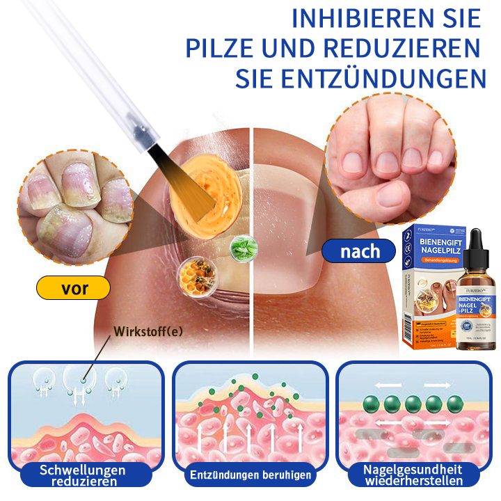 🐝🐝Furzero™ Bienengift Nagelpilz Behandlungslösung:Das Nagelpilzproblem vollständig lösen🌟👣