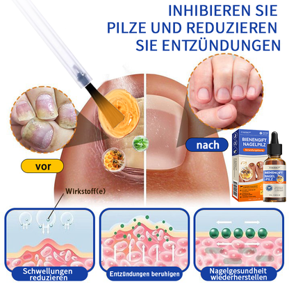 🐝🐝Furzero™ Bienengift Nagelpilz Behandlungslösung:Das Nagelpilzproblem vollständig lösen🌟👣