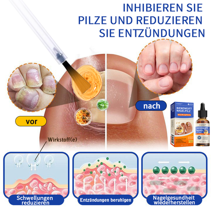 🐝🐝Furzero™ Bienengift Nagelpilz Behandlungslösung