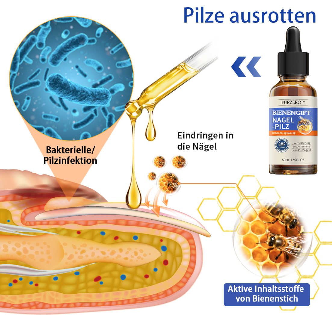 🐝🐝Furzero™ Bienengift Nagelpilz Behandlungslösung