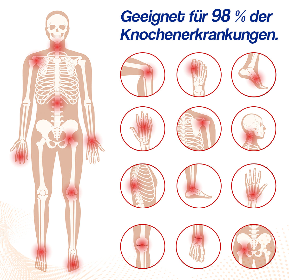 🌟🌟Letzter Tag Rabatt: 70% RABATT🐝🐝Ourlyard™ Bienengift-Gelenktherapie Creme: Schnelle Schmerzlinderung