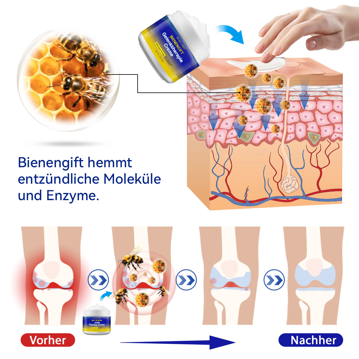 🐝Ourlyard™ Bienengift-Gelenktherapie Creme: Schnelle Schmerzlinderung