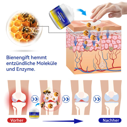 🌟🌟Letzter Tag Rabatt: 70% RABATT🐝🐝Ourlyard™ Bienengift-Gelenktherapie Creme: Schnelle Schmerzlinderung
