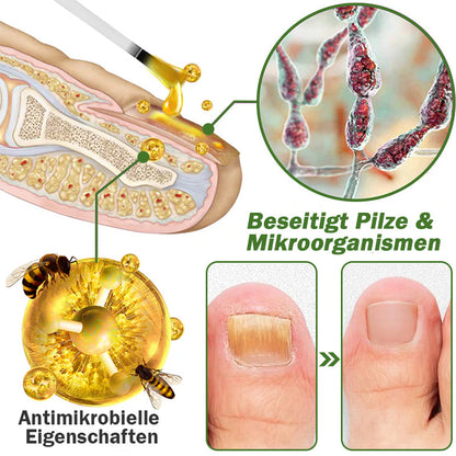 🐝Furzero™ Nagelverteidigung Bienengift-Behandlungsserum pro