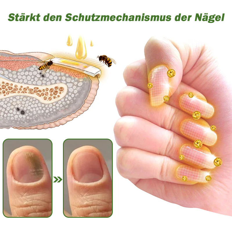 🐝Furzero™ Nagelverteidigung Bienengift-Behandlungsserum pro